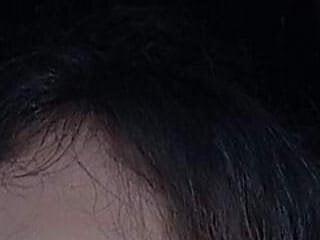 candy hairy