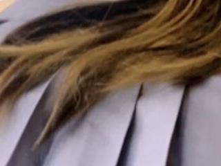 Ms Anal  